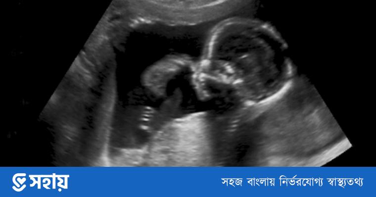 Jinsiy buzuqliklar royxati